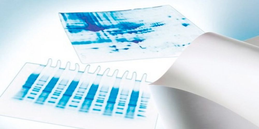 PVDF蛋白印迹膜、印迹膜、转移膜